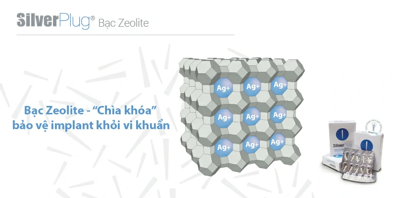 Bạc Zeolite chìa khóa bảo vệ trong quá trình phục hình implant