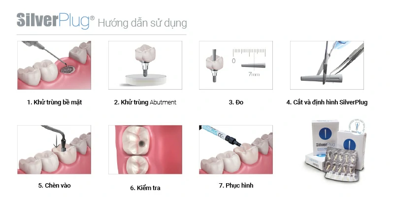 Hướng dẫn sử dụng SilverPlug