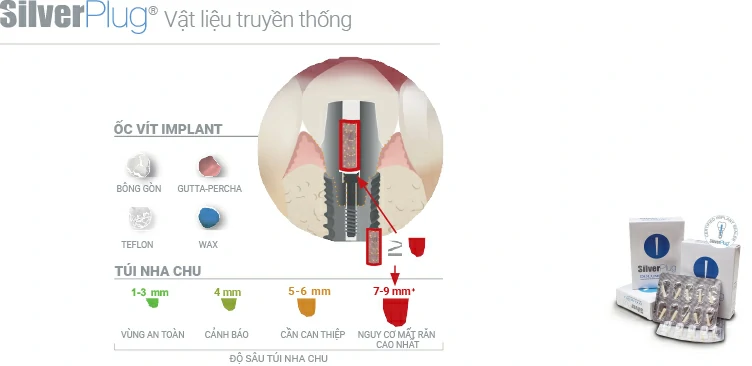 Vật liệu truyền thống thường được sử dụng cho quá trình Implant